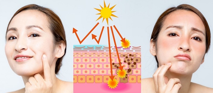 Dengan pemakaian sunscreen, penyerapan UVA dan UVB ke dalam kulit dapat dielakkan.